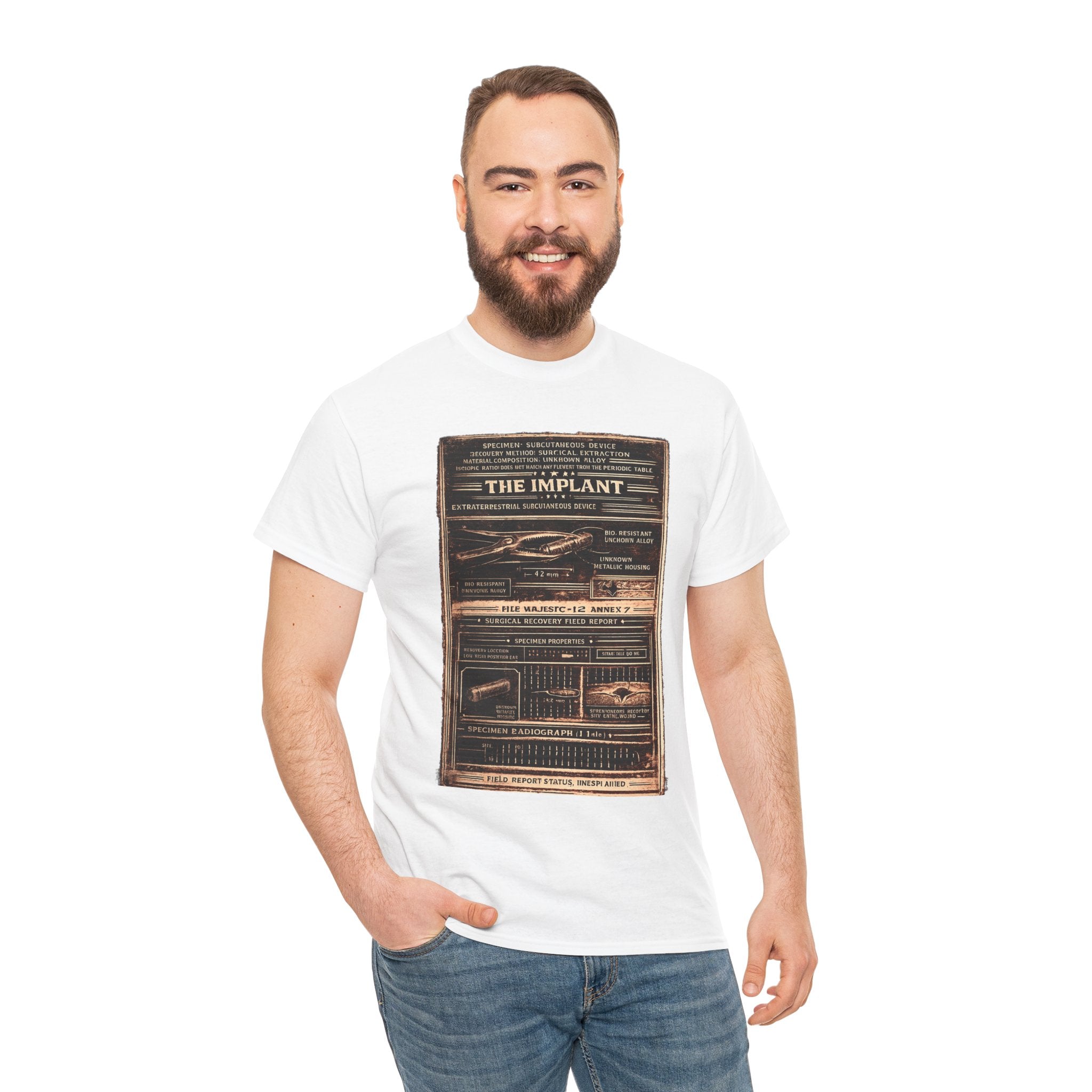 The Implant – Extraterrestrial Subcutaneous Device Surgical Recovery Field Report Vintage Graphic T-Shirt